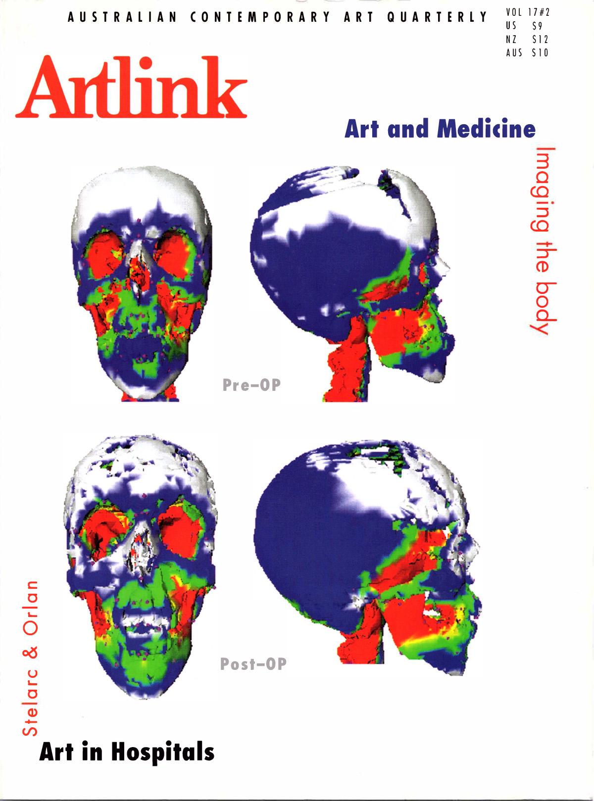 Issue 17:2 | June 1997 | Art & Medicine