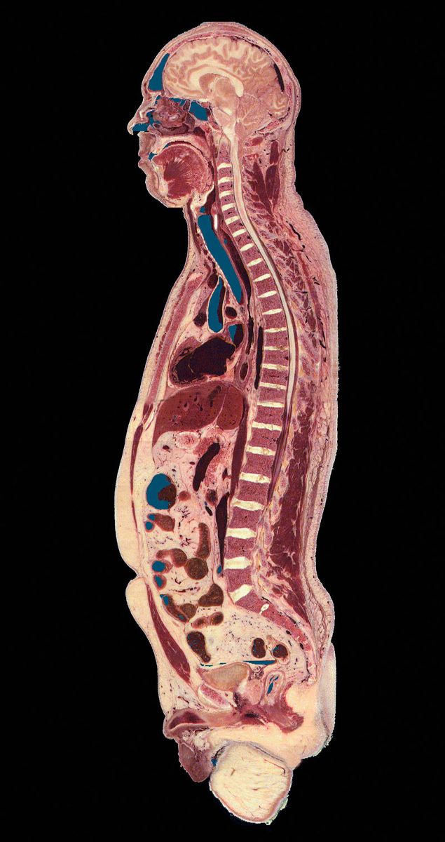 Sagittal view of the visible human. Photo: Callista images. Courtesy Cultura Creative/Alamy Stock Photo 