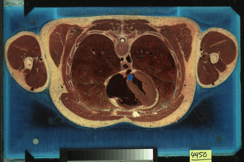 The Visible Human Project, a slice from the Visible Male. Courtesy of the US National Library of Medicine