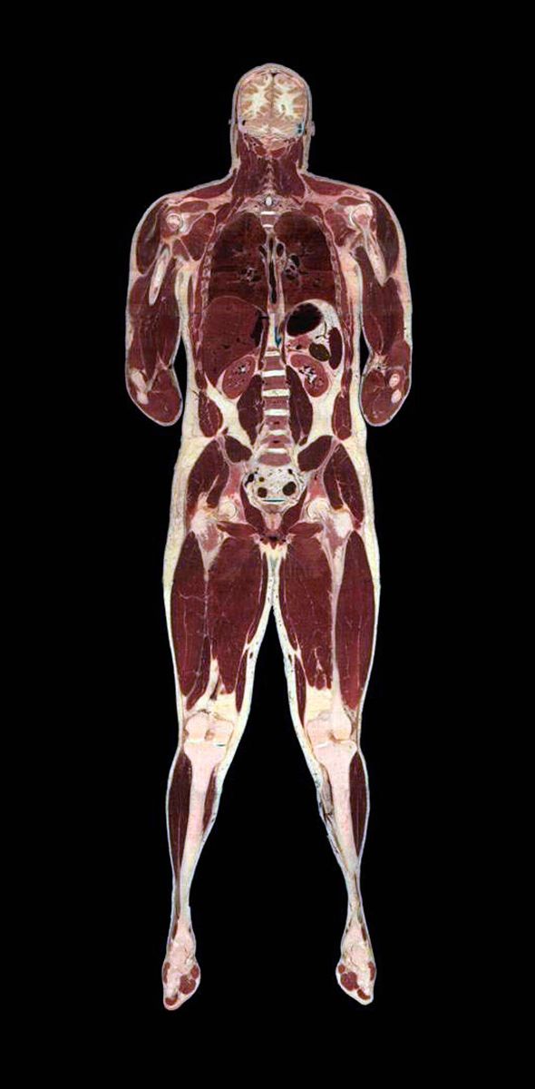 The Visual Human Project, composite image of human anatomy. Photo: Cultura Creative/Alamy